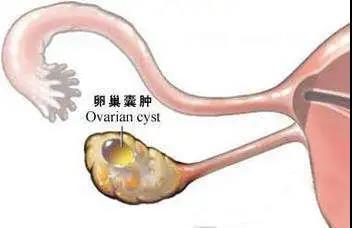 推廣腹腔熱灌注化療 為更多腫瘤患者帶來更多希望