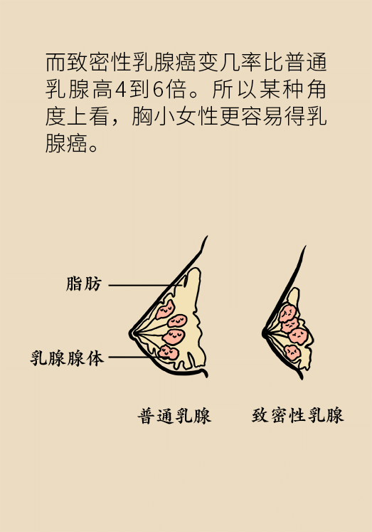 胸小就不會(huì)得乳腺癌嗎？醫(yī)生：患病概率更高