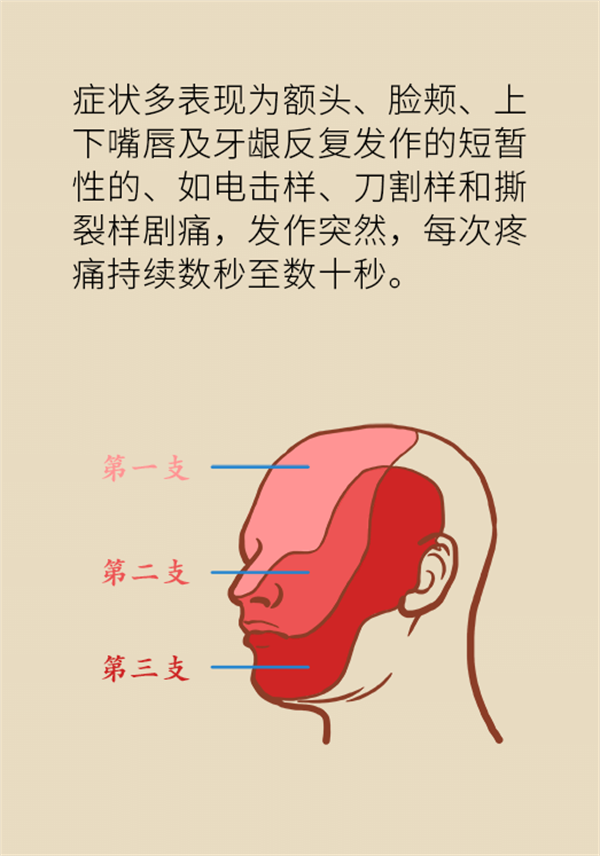 這種疼痛不是牙疼？緩解三叉神經(jīng)痛就用這兩招