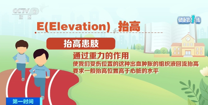 我國超4億人常運動！如何處理急性運動損傷？專家提示